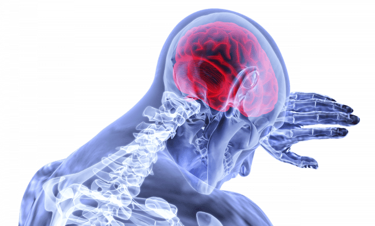 MRI מוח - חשבתם ללכת לנוירולוג פרטי? מה היתרונות ומה העלות הלכה למעשה