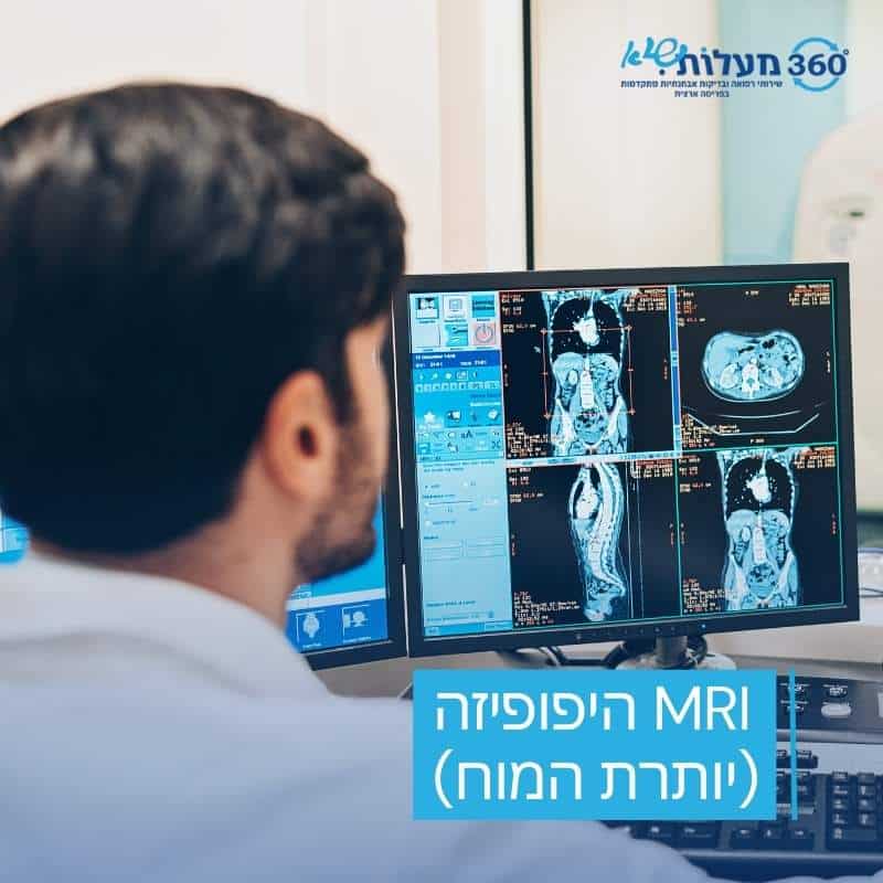 תמונה של רופא בוחן תוצאות MRI ליותרת המוח (היפופיזה) על מסך מחשב. גלו את כל מה שצריך לדעת על בדיקות MRI בתחום הנוירולוגי ואיך הן מסייעות באבחון מצבים רפואיים מורכבים.