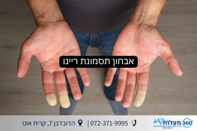 אבחון תסמונת ריינו - 360 מעלות שיא