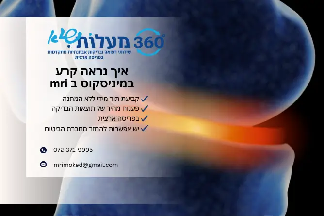 קרע במיניסקוס ב mri - 360 מעלות שיא