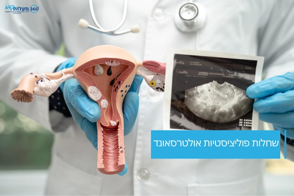 שחלות פוליציסטיות אולטרסאונד