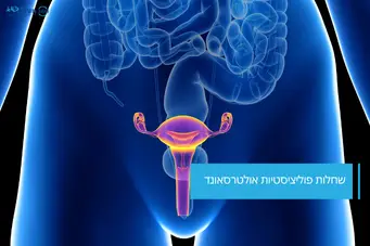 שחלות פוליציסטיות אולטרסאונד תלת מימד - 360 מעלות שיא