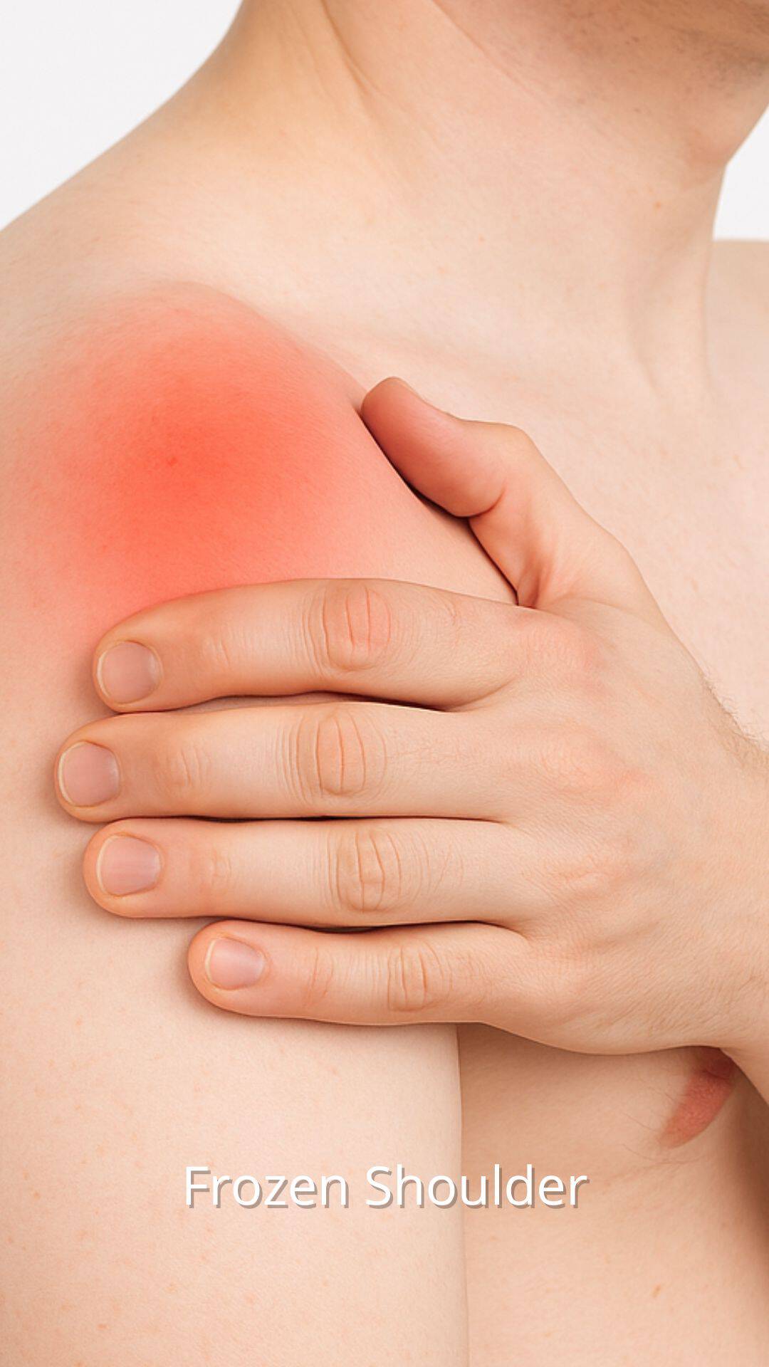 Frozen Shoulder - התייעצות עם אורטופד פרטי
