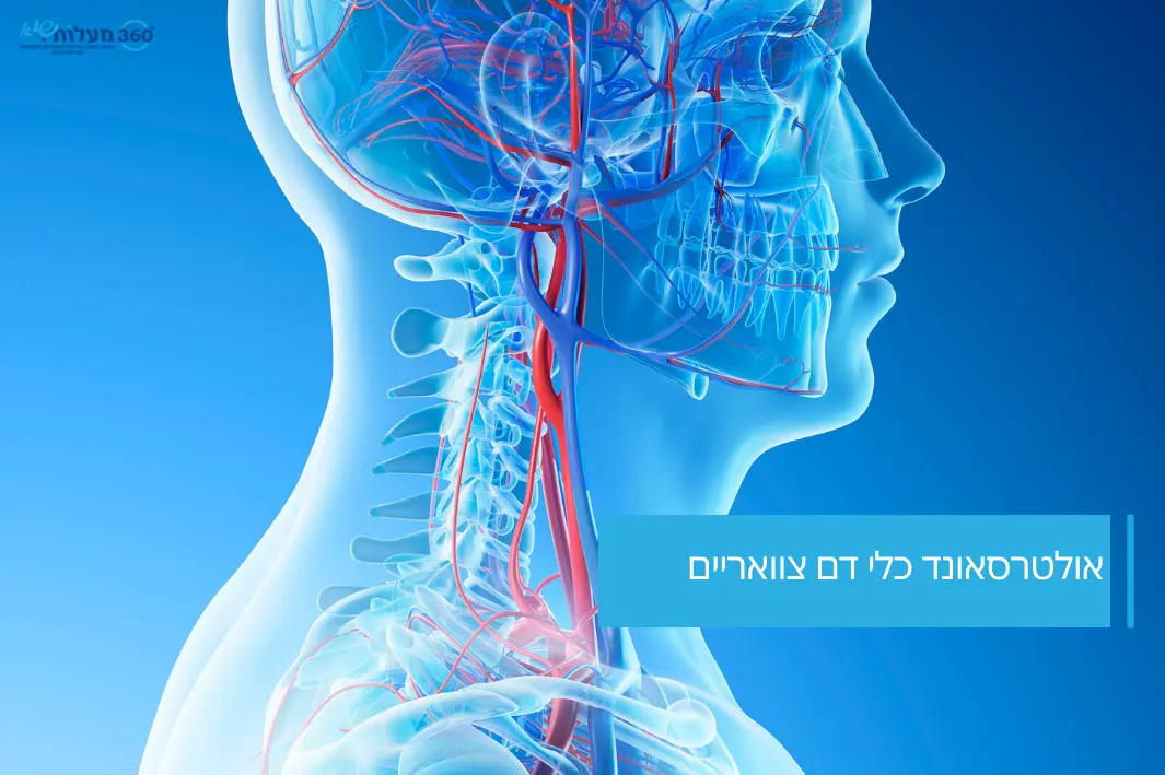 אולטרסאונד כלי דם צוואריים – עורקי הקרוטיד