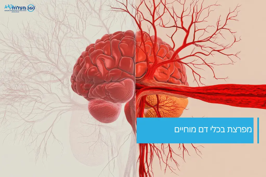 מפרצת בכלי דם מוחיים – המחשה אנטומית