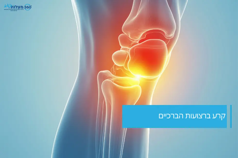 קרע ברצועות הברכיים – הדמיה רפואית של הפגיעה במפרק הברך