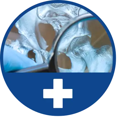 MRI ירך
