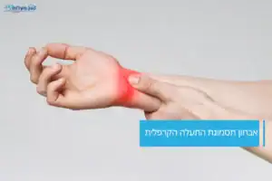 אבחון תסמונת התעלה הקרפלית בכף היד