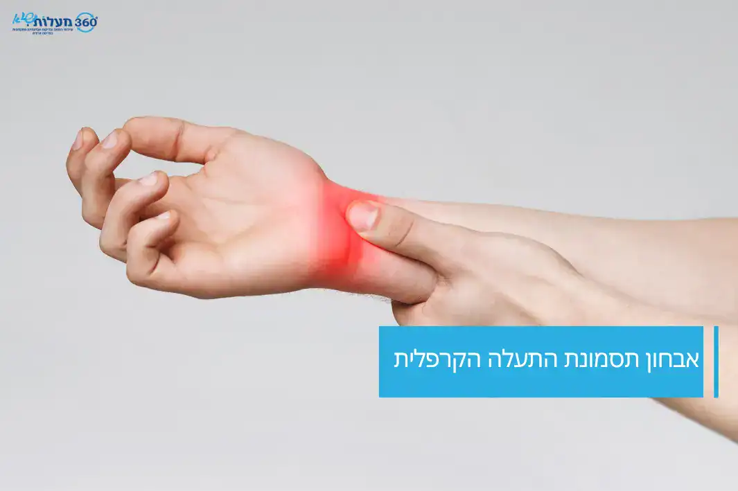 אבחון תסמונת התעלה הקרפלית בכף היד